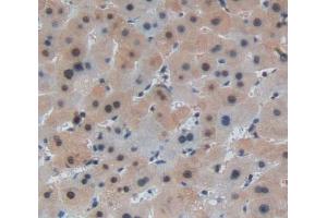 #VALUE! (Leucine Rich Repeats And Death Domain Containing Protein (AA 694-885) antibody)