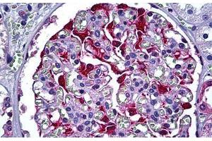 Human Kidney, Glomerulus: Formalin-Fixed, Paraffin-Embedded (FFPE) (S100A6 antibody  (AA 1-91))