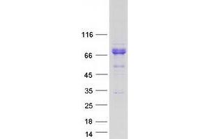 Validation with Western Blot (FLCN Protein (Transcript Variant 1) (Myc-DYKDDDDK Tag))