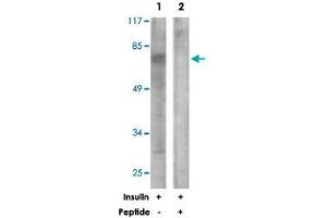 Western blot analysis of extracts from NIH/3T3 cells, treated with Insulin (0.