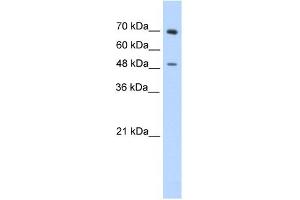 WB Suggested Anti-ZNF821 Antibody Titration:  0.