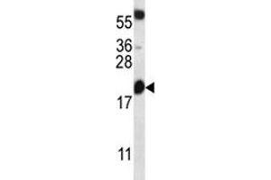 BCL2 antibody western blot analysis in mouse heart tissue lysate (Bcl-2 antibody  (AA 86-114))