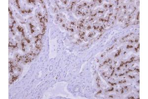 IHC-P Image TPP1 antibody detects TPP1 protein at cytosol on human normal liver by immunohistochemical analysis. (TPP1 antibody)
