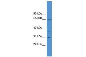 MEPE antibody used at 0. (MEPE antibody  (Middle Region))