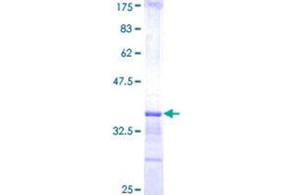 KCNJ5 Protein (AA 136-204) (GST tag)