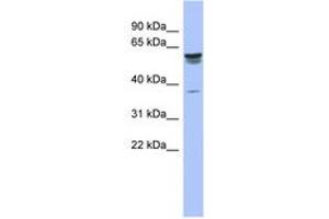 Image no. 1 for anti-Tripartite Motif-containing 4 (TRIM4) (AA 107-156) antibody (ABIN6742533) (TRIM4 antibody  (AA 107-156))