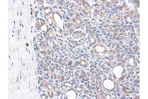 Immunohistochemistry (IHC) image for anti-Chemokine (C-C Motif) Ligand 4 (CCL4) antibody (ABIN2475707)