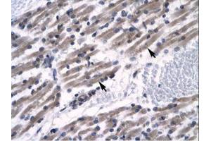 Image no. 1 for anti-Zinc Finger Protein 391 (ZNF391) (AA 66-115) antibody (ABIN6735795) (ZNF391 antibody  (AA 66-115))