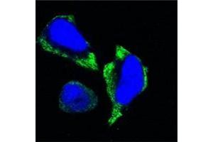 Confocal immunofluorescence analysis of Hela cells using PAK2 antibody (green). (PAK2 antibody)