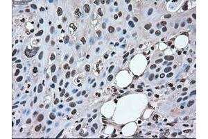 Image no. 1 for anti-Mitogen-Activated Protein Kinase 1 (MAPK1) antibody (ABIN1499291) (ERK2 antibody)