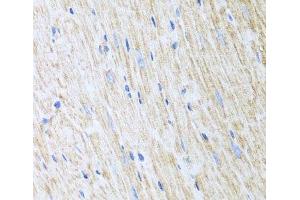 Immunohistochemistry of paraffin-embedded Mouse heart using RCN2 Polyclonal Antibody at dilution of 1:100 (40x lens). (RCN2 antibody)