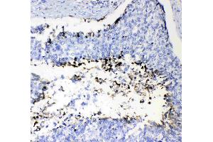 IHC analysis of Prothrombin  using anti-Prothrombin  antibody . (Prothrombin antibody  (AA 67-124))