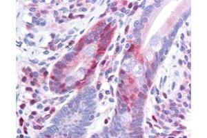 Immunohistochemistry (IHC) image for anti-Programmed Cell Death 4 (PDCD4) (pSer457) antibody (ABIN964683)