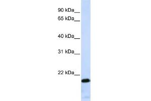 WB Suggested Anti-ZNF428 Antibody Titration:  0. (ZNF428 antibody  (Middle Region))