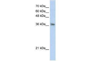 Transfected 293T; WB Suggested Anti-PHYHIP Antibody Titration: 0. (PHYHIP antibody  (N-Term))