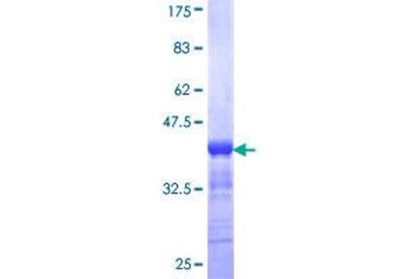 PAK3 Protein (PAK3) (AA 1-90) (GST tag)
