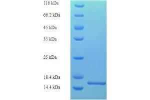 SDS-PAGE (SDS) image for Luteinizing Hormone beta Polypeptide (LHB) (AA 21-141) protein (His tag) (ABIN5709853)