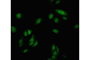 Immunofluorescent analysis of Hela cells using ABIN7148911 at dilution of 1:100 and Alexa Fluor 488-congugated AffiniPure Goat Anti-Rabbit IgG(H+L) (CDKN1C antibody  (AA 221-310))