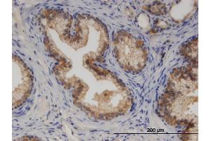 Immunoperoxidase of monoclonal antibody to CYP7B1 on formalin-fixed paraffin-embedded human prostate. (CYP7B1 antibody  (AA 203-286))
