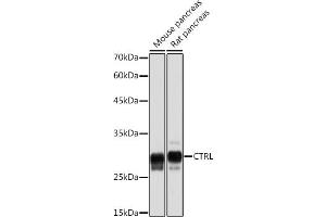 Western blot analysis of extracts of various cell lines, using CTRL Rabbit mAb (ABIN7266395) at 1:5000 dilution. (Chymotrypsin antibody)