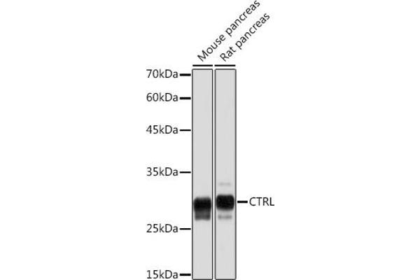 Chymotrypsin anticorps