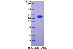 SDS-PAGE (SDS) image for Hexosaminidase A (HEXA) (AA 318-529) protein (His tag) (ABIN2125193)