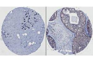 Image no. 3 for anti-Neural Precursor Cell Expressed, Developmentally Down-Regulated 9 (NEDD9) (AA 82-398) antibody (ABIN7278755) (NEDD9 antibody  (AA 82-398))