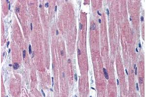 Human Heart: Formalin-Fixed, Paraffin-Embedded (FFPE) (TNNI3 antibody  (C-Term))