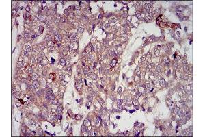 Immunohistochemistry (IHC) image for anti-Insulin-Like Growth Factor 2 (IGF2) (AA 25-180) antibody (ABIN1846026) (IGF2 antibody  (AA 25-180))