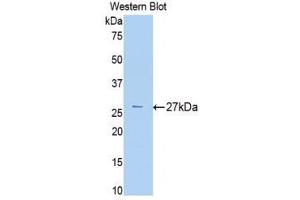 Western Blotting (WB) image for anti-alpha-2-Macroglobulin (A2M) (AA 216-437) antibody (ABIN1077782) (alpha 2 Macroglobulin antibody  (AA 216-437))