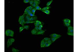 Immunofluorescence staining of HepG2 cells with ABIN7154468 at 1:100, counter-stained with DAPI. (GADD45B antibody  (AA 1-160))