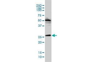 MGC10540 monoclonal antibody (M01), clone 2E5-2B9 Western Blot analysis of MGC10540 expression in Hela S3 NE . (VPS25 antibody  (AA 1-176))