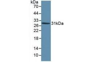 Detection of Recombinant KLK1, Human using Polyclonal Antibody to Kallikrein 1 (KLK1) (Kallikrein 1 antibody  (AA 25-261))