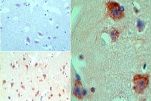 Image no. 1 for anti-Histone Deacetylase 9 (HDAC9) (AA 100-150) antibody (ABIN960197) (HDAC9 antibody  (AA 100-150))