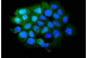 IF analysis of SLBP using anti-SLBP antibody (ABIN7600074).