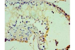 IHC analysis of paraffin-embedded human kidney tissue, using ASH2L antibody (1/100 dilution).