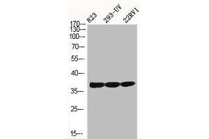Western Blot analysis of 823 293-UV 22RV1 cells using Phospho-p38 (Y323) Polyclonal Antibody (MAPK14 antibody  (pTyr323))