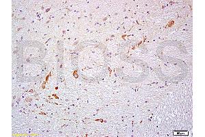 Formalin-fixed and paraffin embedded rat brain labeled with Anti- PROK2/Prokineticin 2 Polyclonal Antibody, Unconjugated (ABIN714701) at 1:200 followed by conjugation to the secondary antibody and DAB staining (PROK2 antibody  (AA 28-100))