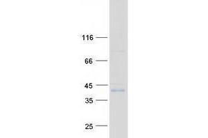 Validation with Western Blot (ZDHHC15 Protein (Myc-DYKDDDDK Tag))