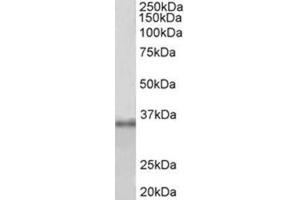 Western Blotting (WB) image for anti-Fibrillarin (FBL) (Internal Region) antibody (ABIN1107198) (Fibrillarin antibody  (Internal Region))