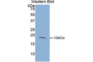 Western Blotting (WB) image for anti-Eosinophil Cationic Protein (ECP) (AA 33-155) antibody (ABIN1860457) (RNASE3 antibody  (AA 33-155))