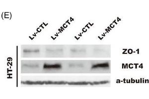 MCT4 destroys epithelial barrier function and inhibits ZO-1 expression.