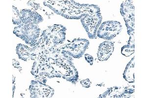 Formalin-fixed, paraffin-embedded tissue section of mouse thyroid stained with a mouse IgM isotype control. (ERBB3 antibody)