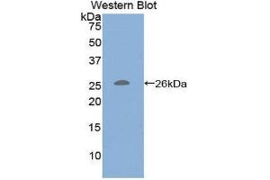 Western Blotting (WB) image for anti-CD79b Molecule, Immunoglobulin-Associated beta (CD79B) (AA 37-226) antibody (ABIN1859292)