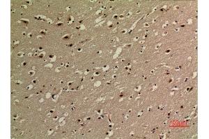Immunohistochemistry (IHC) analysis of paraffin-embedded Human Brain, antibody was diluted at 1:100. (NF-kB p65 antibody  (acLys314, acLys315))