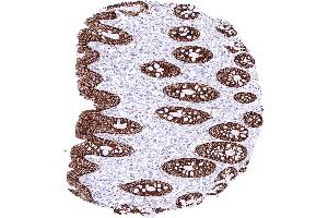 Rectum mucosa with a strong membranous CLDN3 staining of all epithelial cells