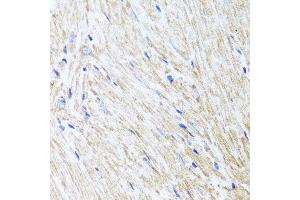 Immunohistochemistry of paraffin-embedded mouse heart using L2HGDH antibody at dilution of 1:100 (x40 lens). (L2HGDH antibody)