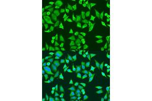 Immunofluorescence analysis of U2OS cells using SMN2 antibody (ABIN6127948, ABIN6148135, ABIN6148138 and ABIN6216175) at dilution of 1:100.