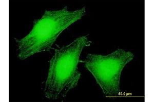 Immunofluorescence of purified MaxPab antibody to LARP6 on HeLa cell. (LARP6 antibody  (AA 1-491))