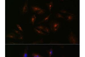 Immunofluorescence analysis of U-251 MG cells using ABCA2 Polyclonal Antibody at dilution of 1:100 (40x lens). (ABCA2 antibody)